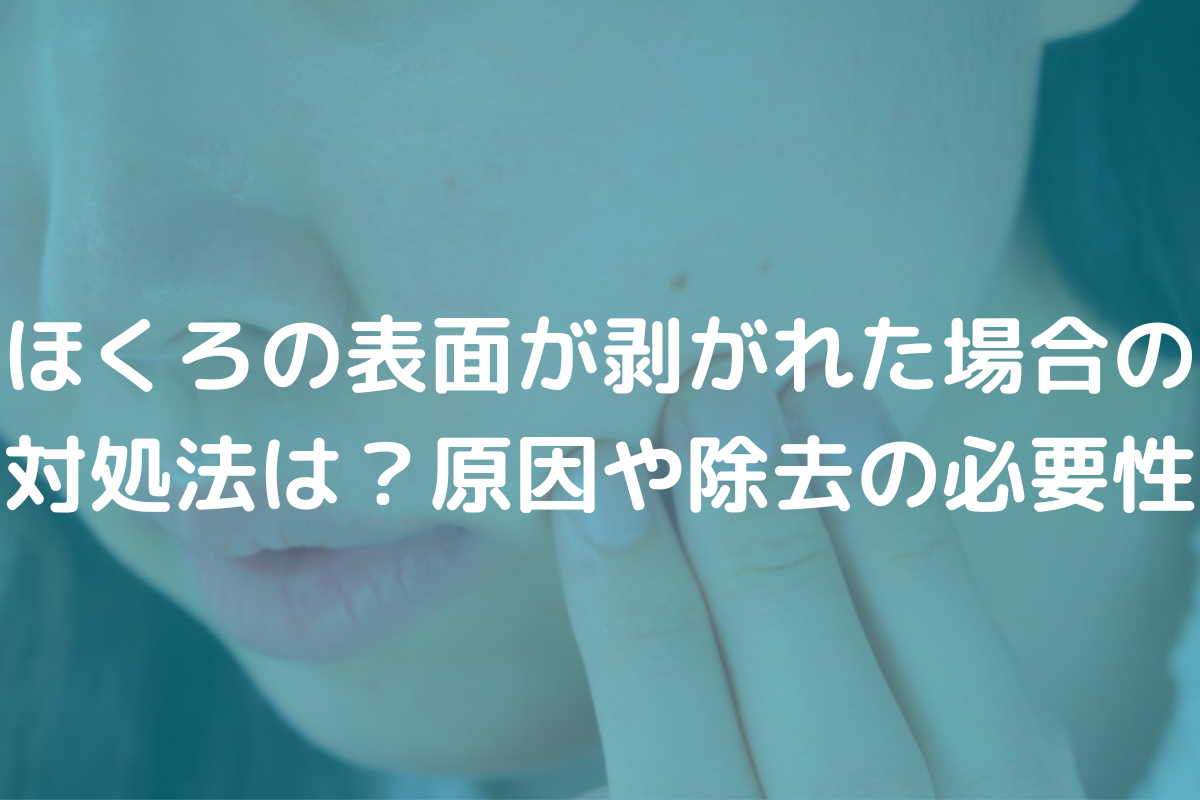 ほくろの表面が剥がれた場合の対処法