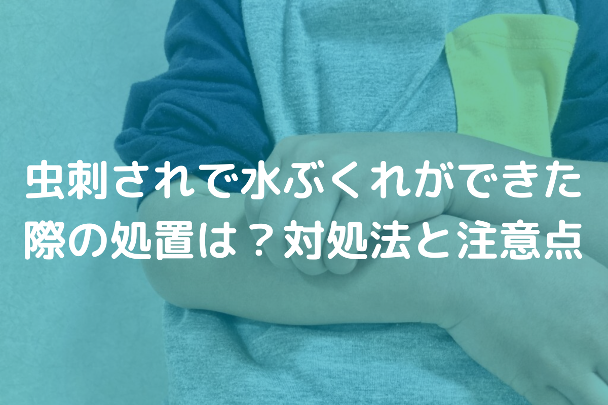 虫刺されで水ぶくれができた際の処置