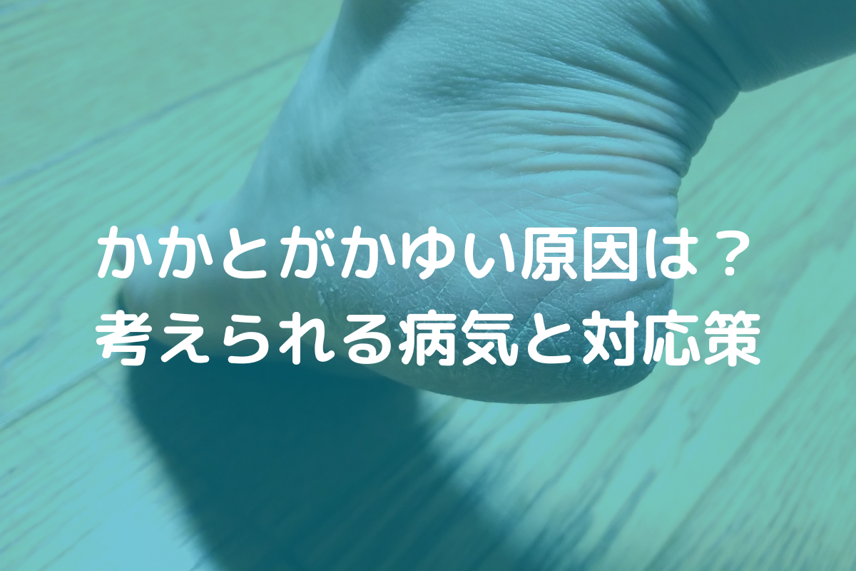 かかとがかゆい原因は？考えられる病気と対応策