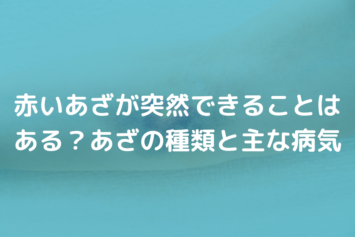 赤いあざが突然できる