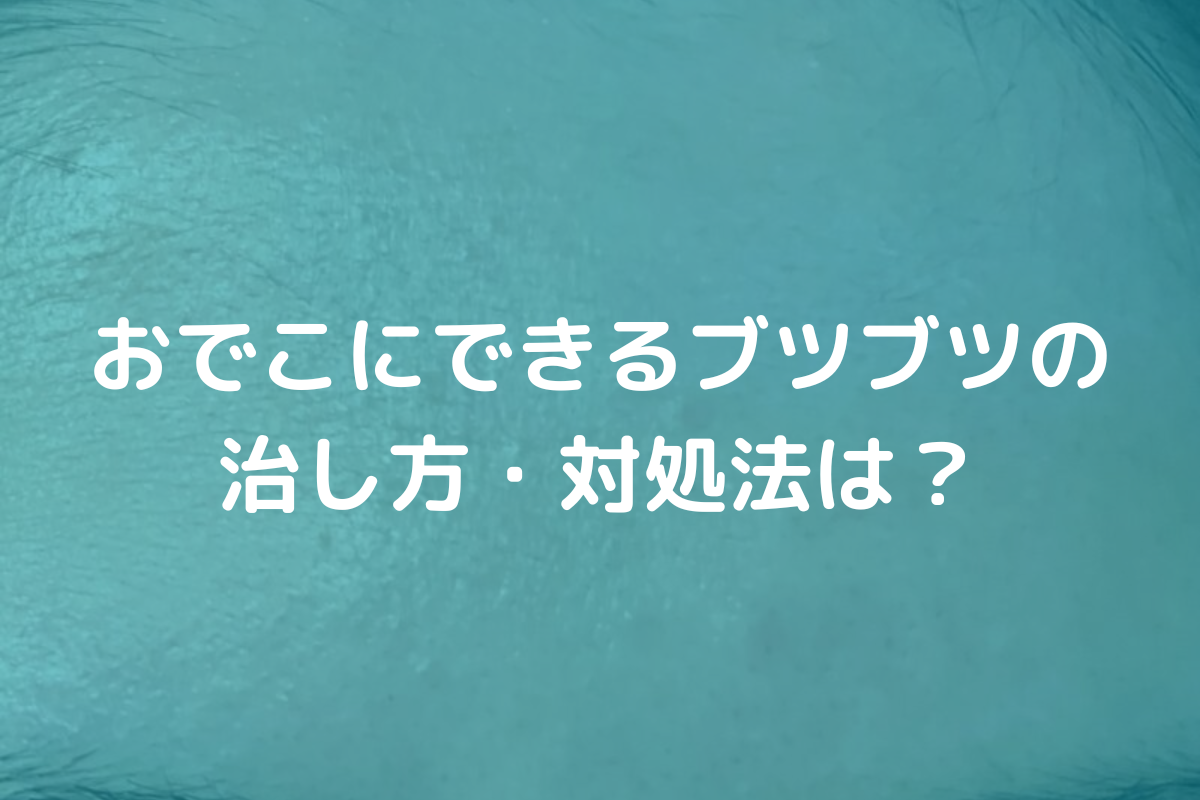 おでこにできるブツブツの治し方・対処法