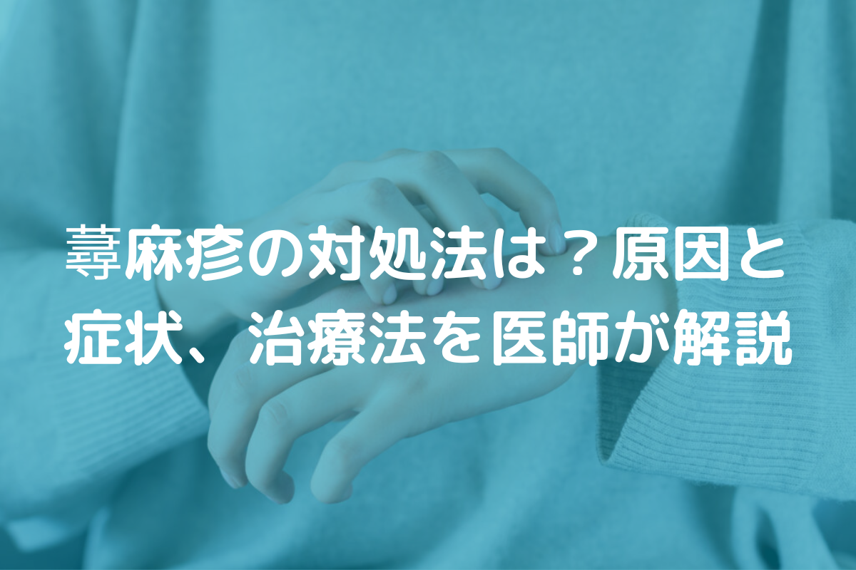 蕁麻疹の対処法は？原因と症状、治療法を医師がわかりやすく解説